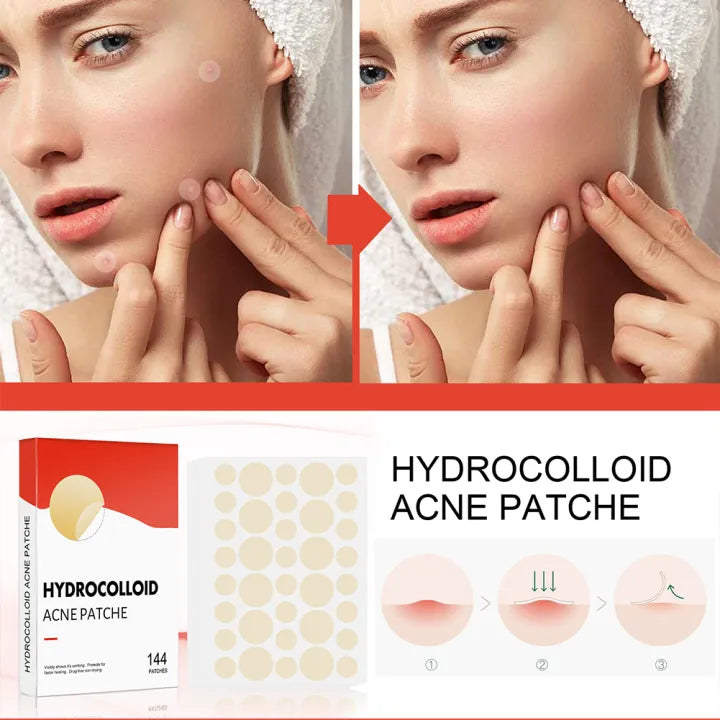 Pimple Patch |Invisible Acne Pimple Patch Stickers